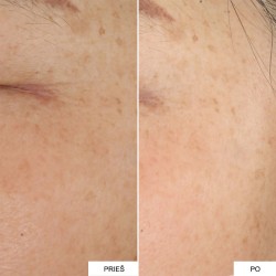 Ren Clean Skincare Radiance Overnight Glow Dark Spot Sleeping Cream - Naktinis Veido Kremas 50 ml