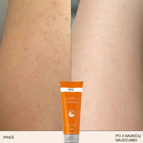 Ren Clean Skincare Radiance AHA Smart Renewal 200 ml