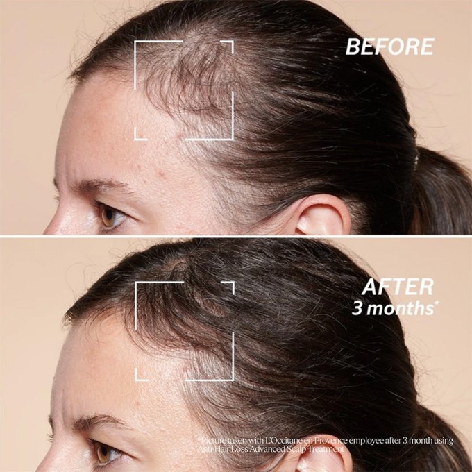 L´occitane Anti-Hair Loss Serum - serumas nuo plaukų slinkimo, 50 ml