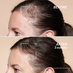 L´occitane Anti-Hair Loss Serum - serumas nuo plaukų slinkimo, 50 ml