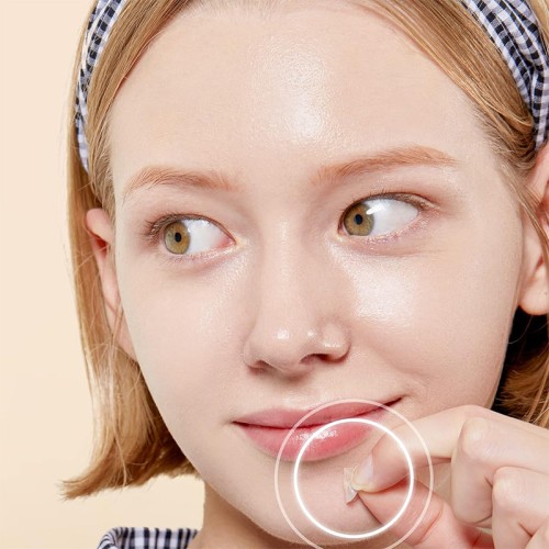 COSRX Basic Master Patch - spuogų pleistriukai, 90 vnt.