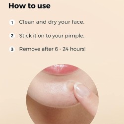 COSRX Basic Master Patch - spuogų pleistriukai, 90 vnt.