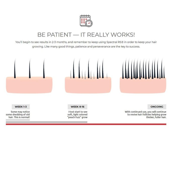 DS Laboratories Spectral.Rs Anti-Thinning Hair Treatment - gydymas nuo palukų slinkimo, 60 ml