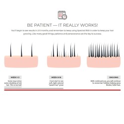 DS Laboratories Spectral.Rs Anti-Thinning Hair Treatment - gydymas nuo palukų slinkimo, 60 ml