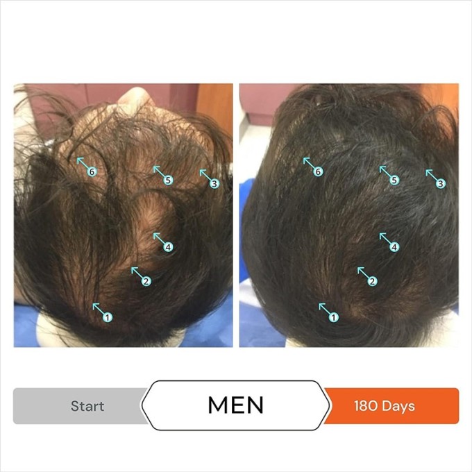 DS Laboratories Revita Tablets For Hair Growth Support - plaukų augimą skatinantis papildas, 90 vnt.