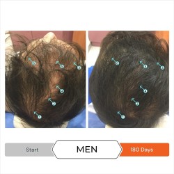 DS Laboratories Revita Tablets For Hair Growth Support - plaukų augimą skatinantis papildas, 90 vnt.