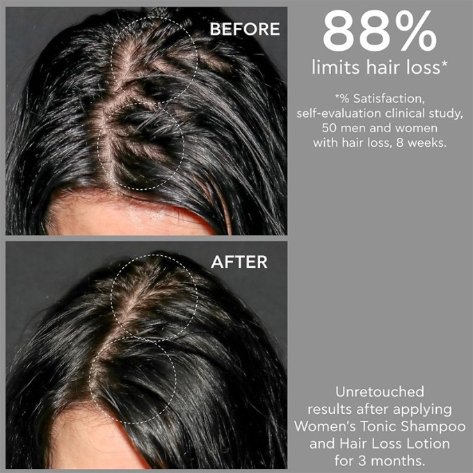 Apivita Women's Tonic Shampoo - šampūnas nuo plaukų slinkimo moterims, 500 ml