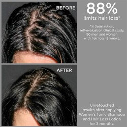 Apivita Women's Tonic Shampoo - šampūnas nuo plaukų slinkimo moterims, 500 ml