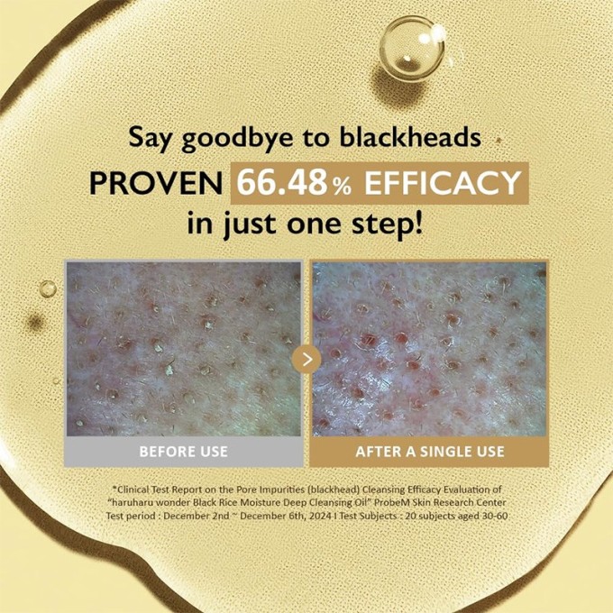 Haruharu Wonder Black Rice Moisture Deep Cleansing Oil Vegan - drėkinamasis ir švelniai valantis