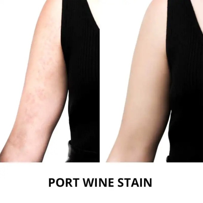 Artdeco Camouflage Cream - maskuojantis makiažo pagrindas, 4,5 g - 5 Light Whisney