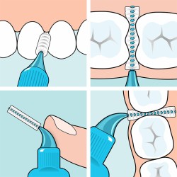 TePe Interdental Brush Extra Soft (0.5 mm pink 8 pcs) - Very fine interdental brushes 8 pcs