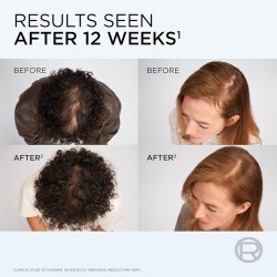 L´Oréal Professionnel Elseve Growth Booster Anti-Fall Scalp Serum - plaukų augimą skatinantis