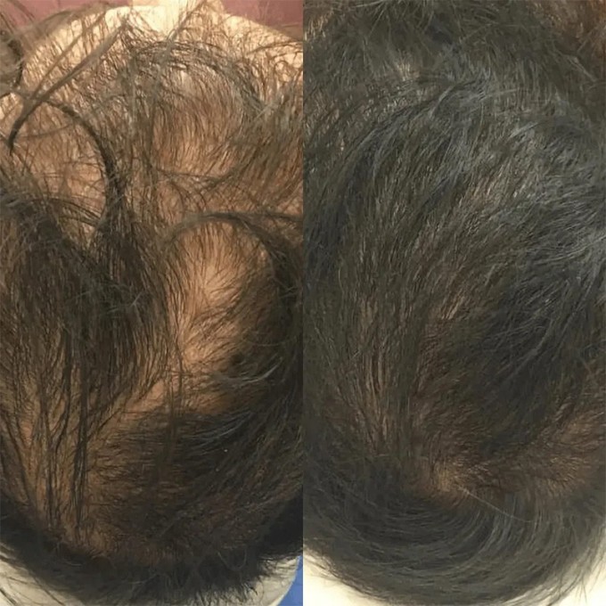 DS Laboratories Revita Hair Care Set - rinkinys plaukų priežiūrai