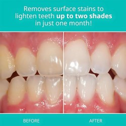 Opalescence Whitening Toothpaste ( Cool Mint ) - Whitening toothpaste 133 g