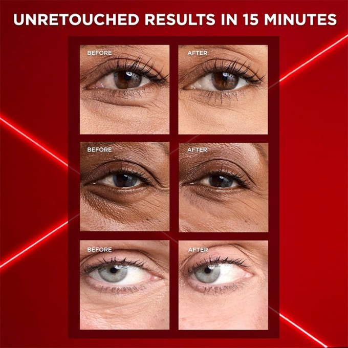 L´Oréal Revitalift Laser Eye Bag Instant Eraser - kasdienė maišelių po akimis priežiūros priemonė