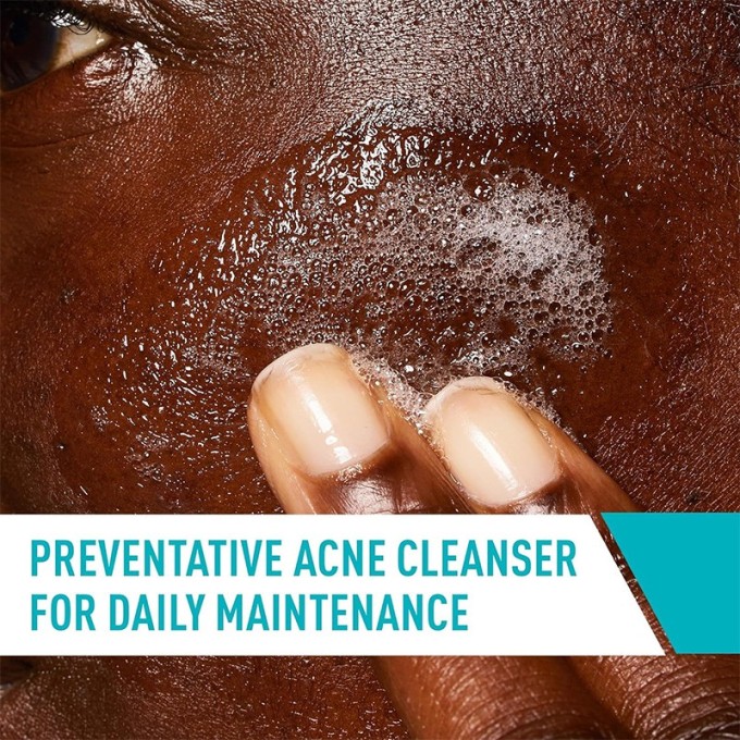 CeraVe Facial Cleansers Blemish Control Cleanser - veido prausiklis spuoguotai odai, 473 ml