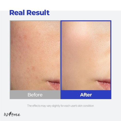 Isntree Hyaluronic Acid Aqua Gel Cream 100 ml