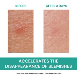 Uriage Local care at night against skin imperfections acne Hyséac (SOS Paste Local Skin- Care ) 15