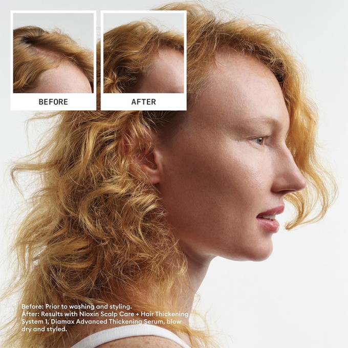 Nioxin System 1 Scalp Treatment 1 - Hair treatment for fine, slightly thinning natural hair 100 ml